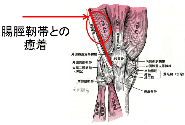 腸脛靭帯と外側広筋の位置